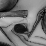 PROCARE-Fluid-Management-Service-Equipment