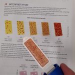 How to use a dipslide test kit – compare the dipslide results